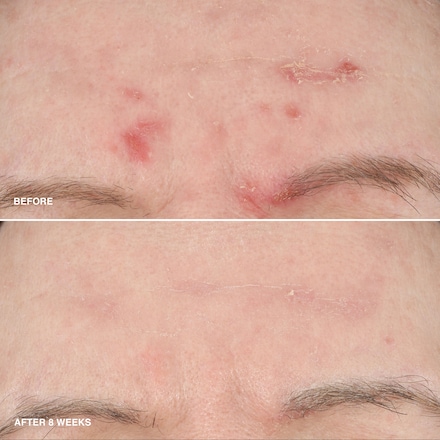 Mini Vitamin Enriched Smoothing Serum